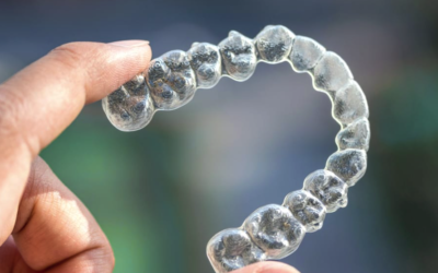 Benefits of Stittsville Invisalign