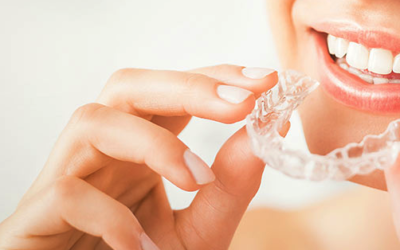 How to Enjoy the Best Results from Perth Invisalign